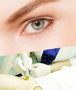 Hair Removal Staten Island