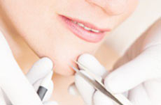 Hair Removal Staten Island