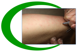 electrolysis staten island